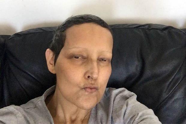 Betty Lago Câncer