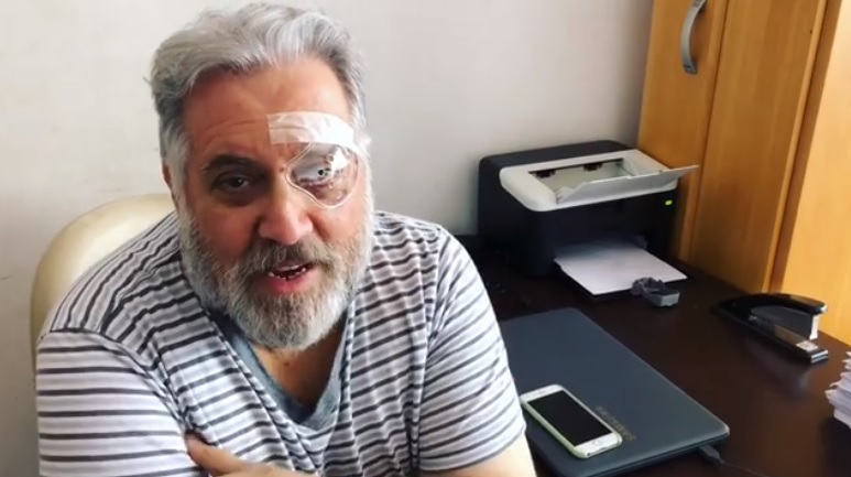 Leao Lobo esteve fora do Fofocalizando apos passar por cirurgia