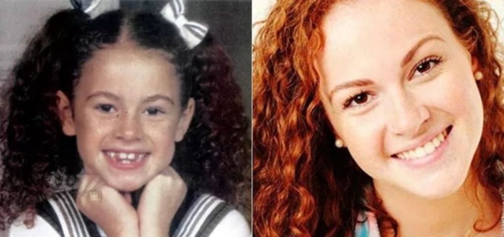 Beatriz Botelho antes e depois