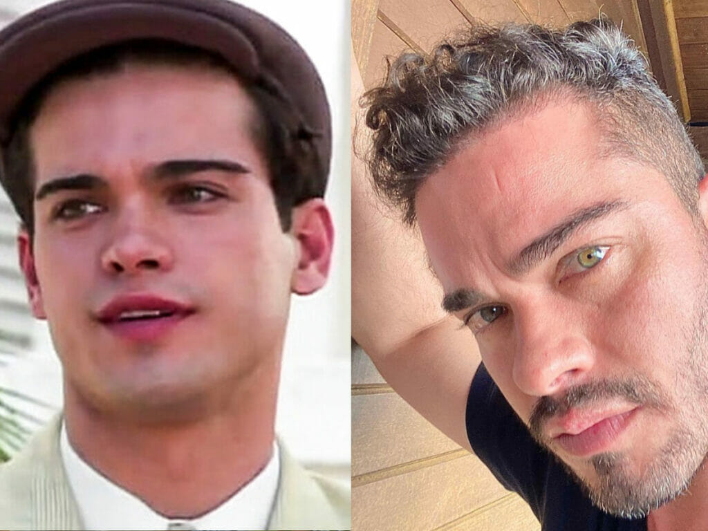 Antes e depois de Sidney Sampaio