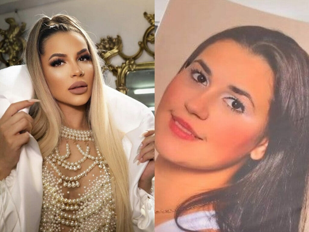 Deolane Bezerra