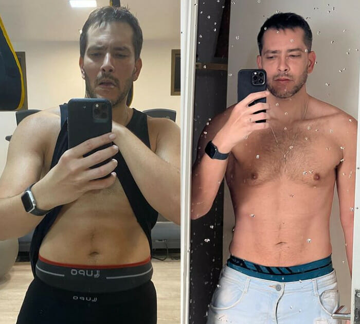 Antes e depois de Bento Ribeiro