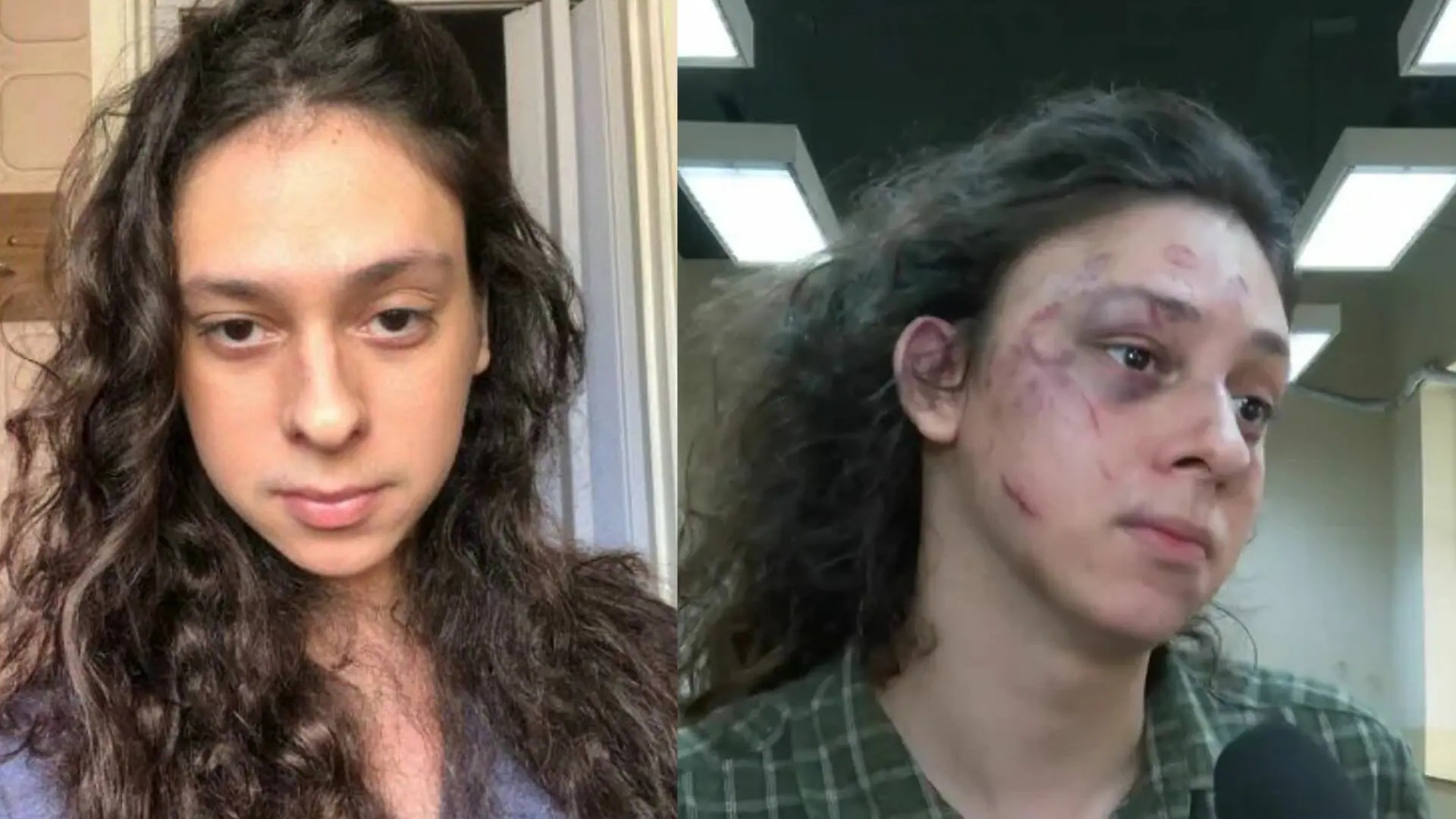 Victor Meyniel; ao lado, o ator após agressões brutais