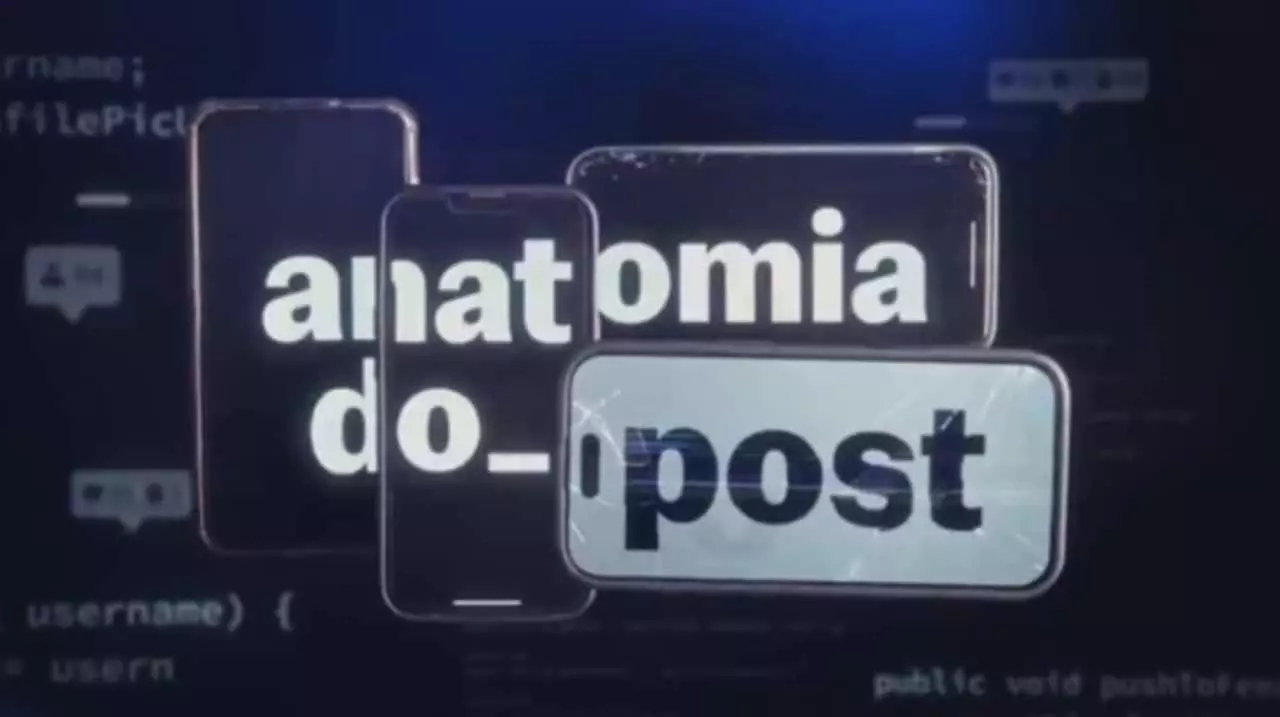 Anatomia do Post